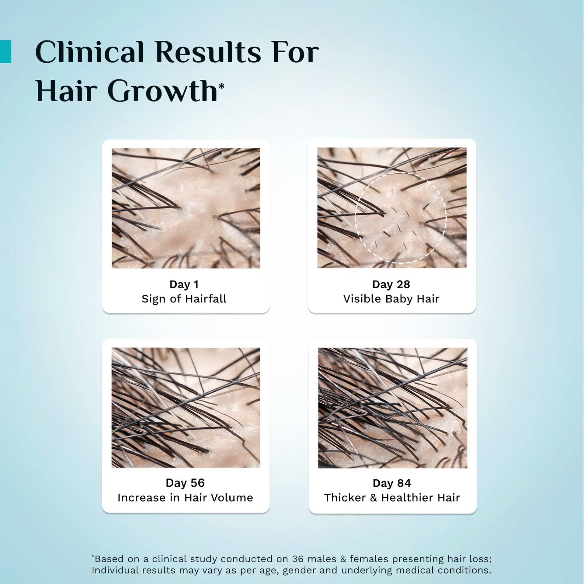 Pilgrim Redensyl 3% + Anagain 4% Hair Growth Serum - Image 8